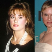 10 stars who have had chin plastic surgery