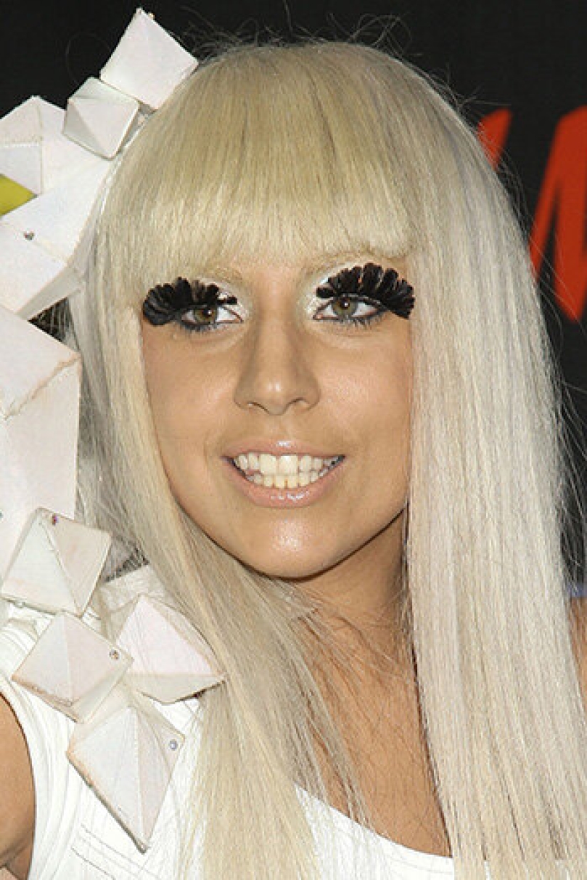 10 stars who have had chin plastic surgery 10 stars who have had chin plastic surgery