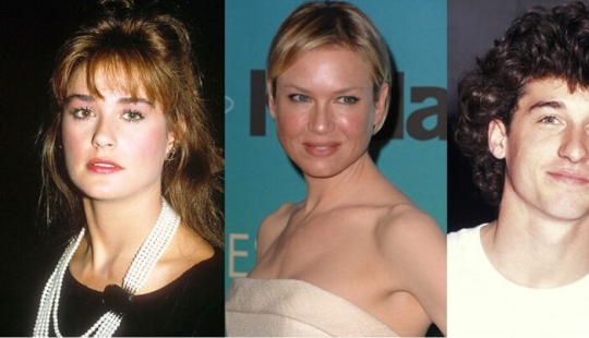 10 stars who have had chin plastic surgery 10 stars who have had chin plastic surgery