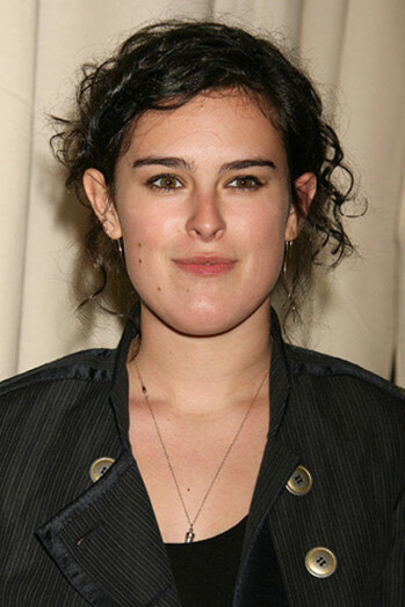 10 stars who have had chin plastic surgery 10 stars who have had chin plastic surgery