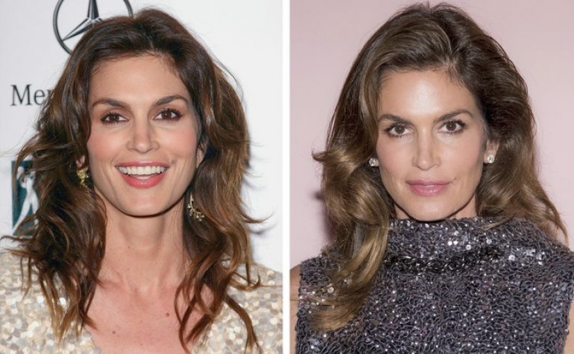 11 celebridades que revelaron con orgullo que se sometieron a una cirugía estética y no se arrepintieron 11 celebridades que revelaron con orgullo que se sometieron a una cirugía estética y no se arrepintieron