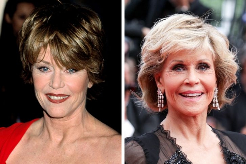 11 celebridades que revelaron con orgullo que se sometieron a una cirugía estética y no se arrepintieron 11 celebridades que revelaron con orgullo que se sometieron a una cirugía estética y no se arrepintieron