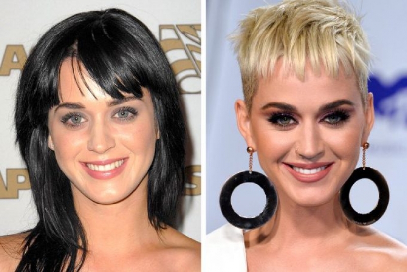 11 celebrities who proudly revealed they had cosmetic surgery and didn't regret it