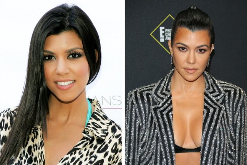 11 celebrities who proudly revealed they had cosmetic surgery and didn't regret it