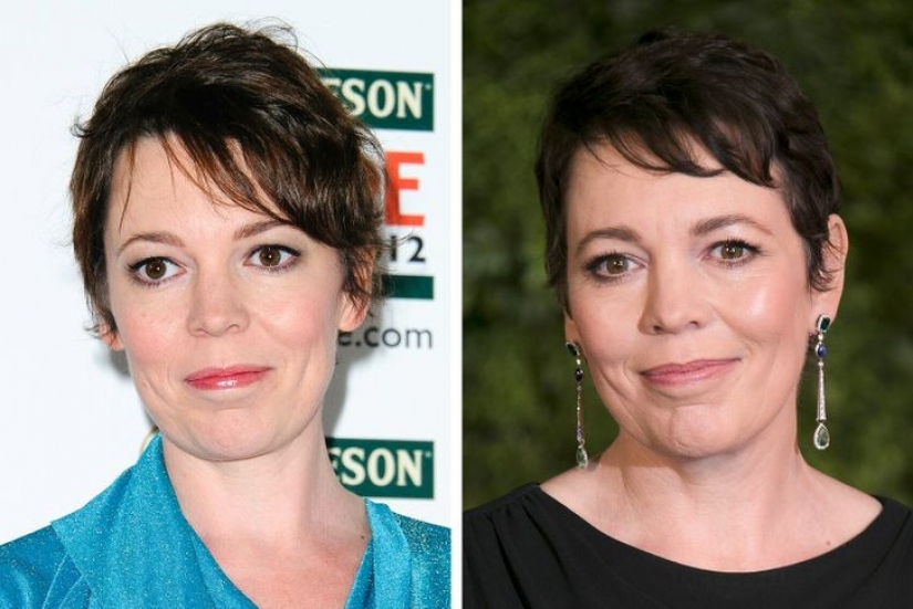 11 celebrities who proudly revealed they had cosmetic surgery and didn't regret it