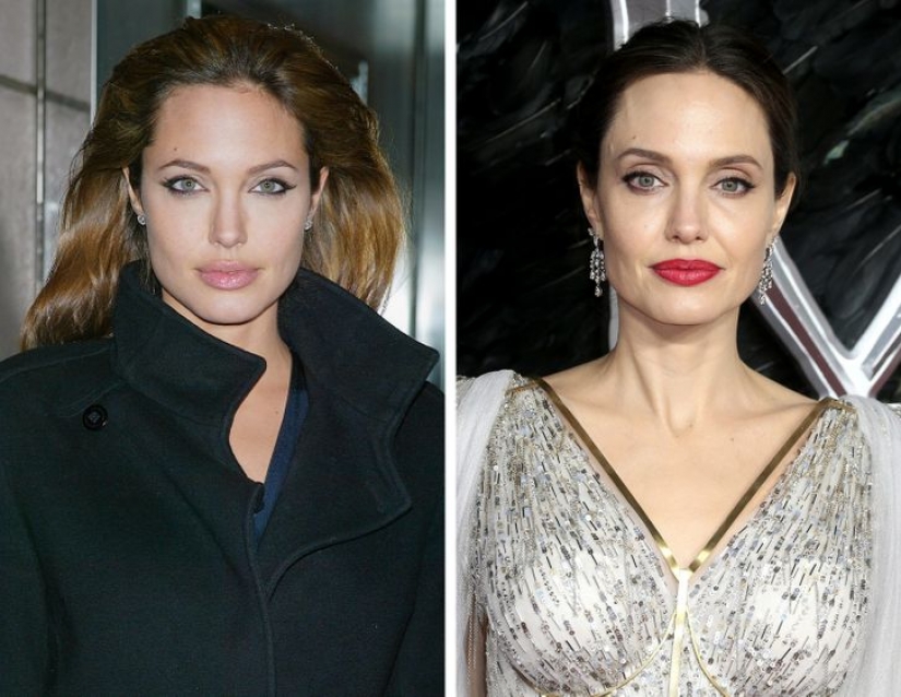 11 celebrities who proudly revealed they had cosmetic surgery and didn't regret it