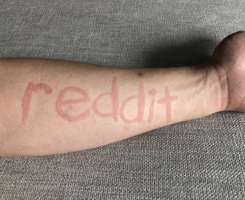 11 personas comunes con superpoderes inusuales