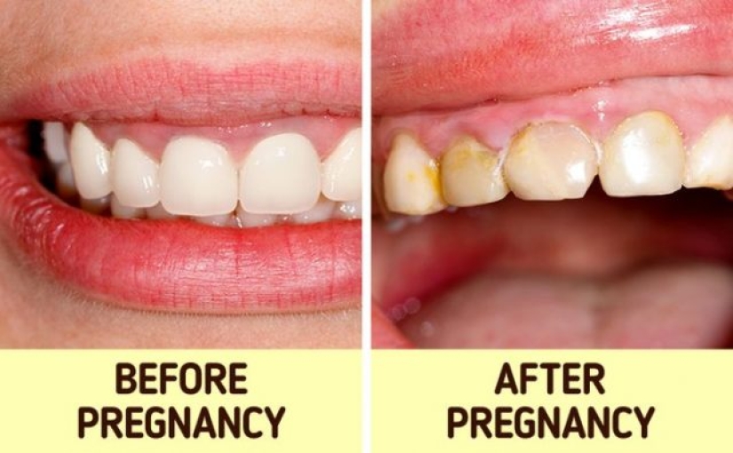 14 amazing facts about motherhood that mothers prove to be superheroes themselves