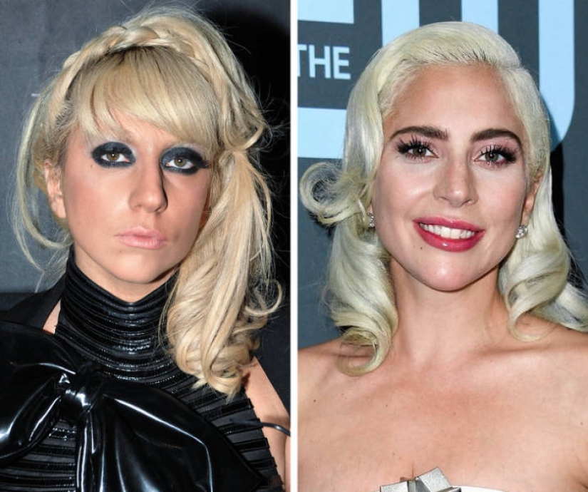 15 celebrities who has changed most over the last decade