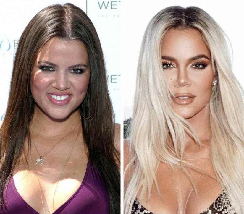 15 celebrities who has changed most over the last decade