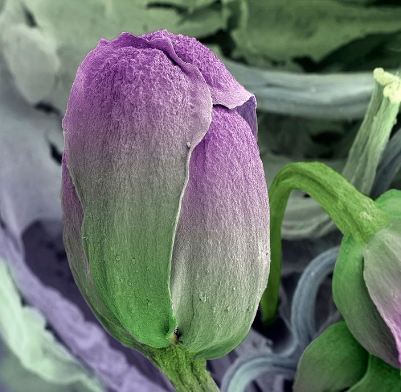 15 fascinantes fotos de productos bajo el microscopio 15 fascinantes fotos de productos bajo el microscopio