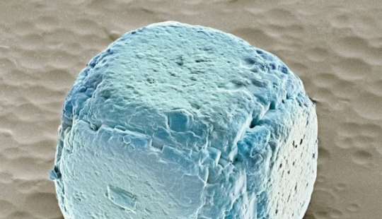 15 fascinantes fotos de productos bajo el microscopio 15 fascinantes fotos de productos bajo el microscopio