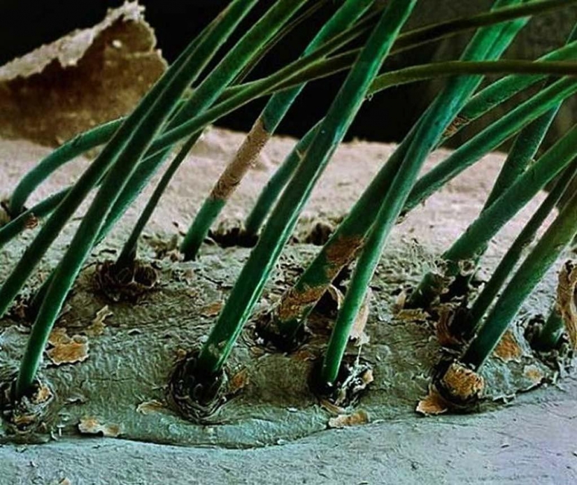 15 increíbles criaturas que no se pueden ver sin un microscopio