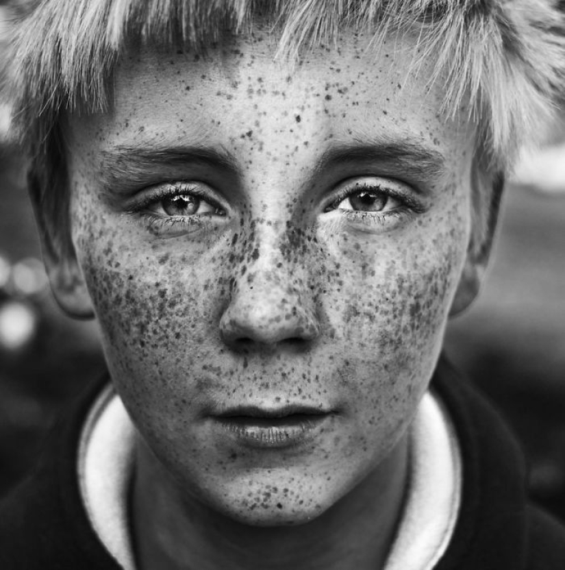 16 fascinating photos of people with freckles