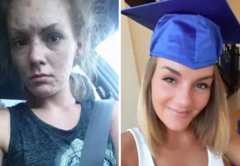 25 fotos de personas antes y después de superar la adicción