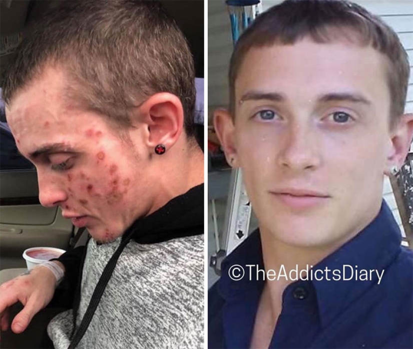 25 fotos de personas antes y después de superar la adicción