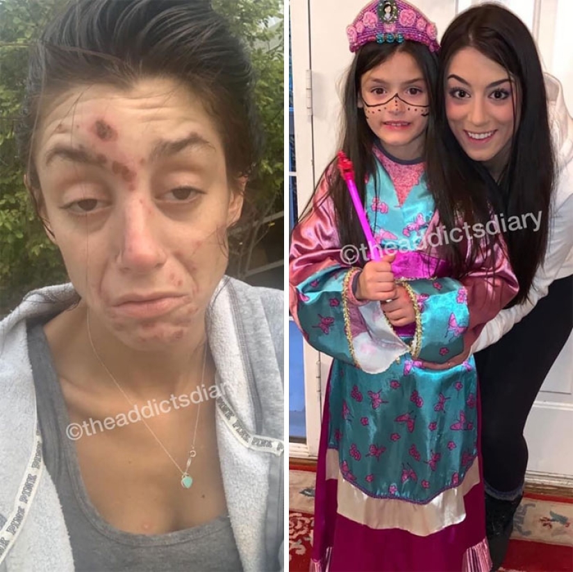 25 fotos de personas antes y después de superar la adicción