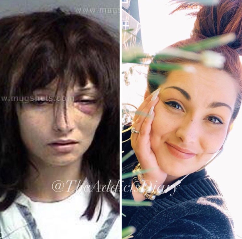 25 fotos de personas antes y después de superar la adicción
