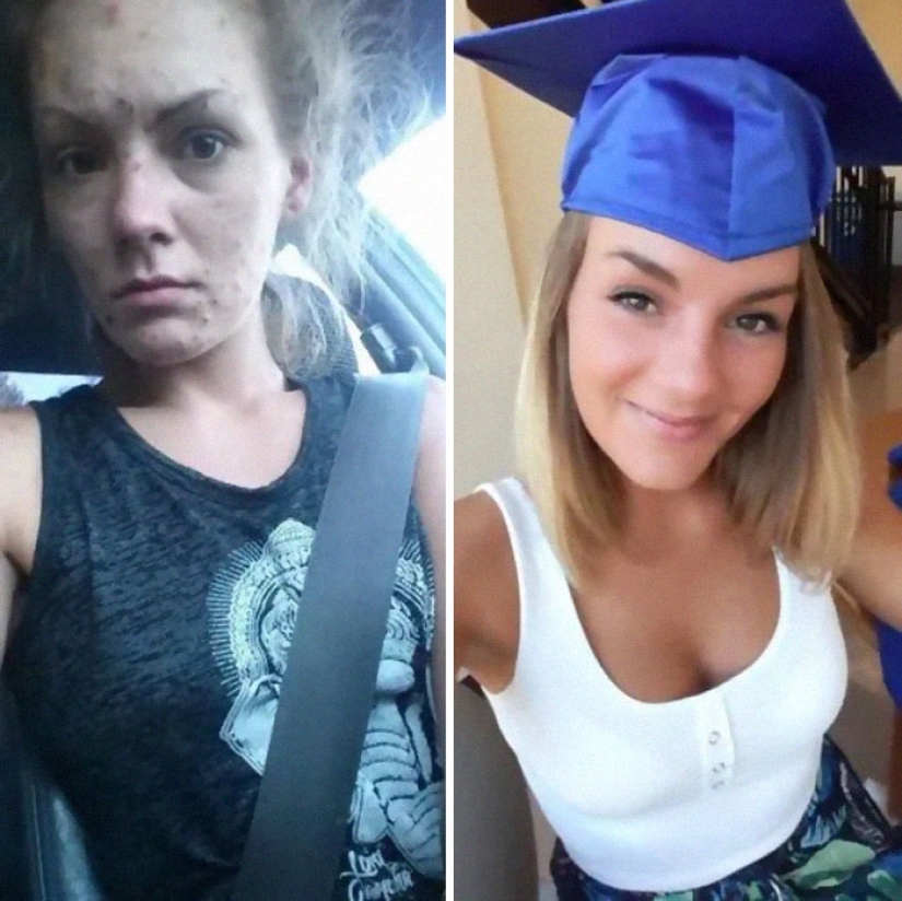 25 photos of people before and after overcoming addiction