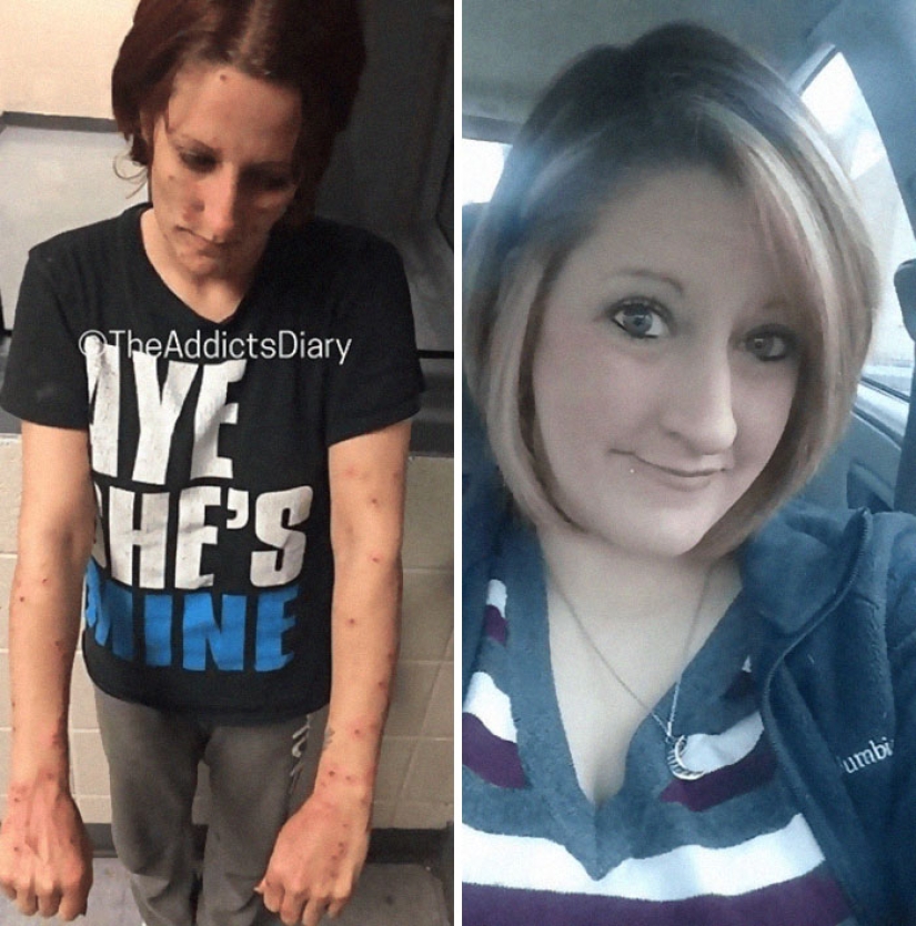 25 photos of people before and after overcoming addiction