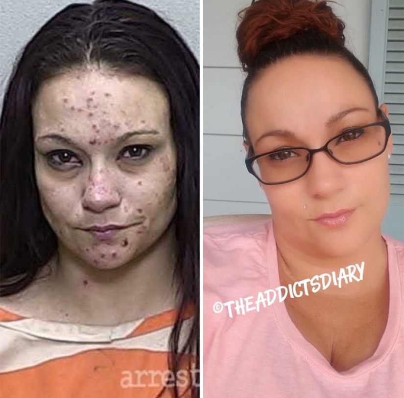 25 photos of people before and after overcoming addiction