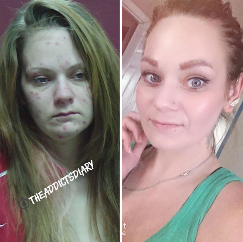 25 photos of people before and after overcoming addiction