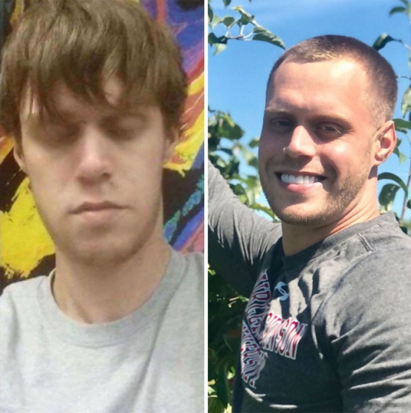 25 photos of people before and after overcoming addiction