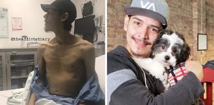 25 photos of people before and after overcoming addiction