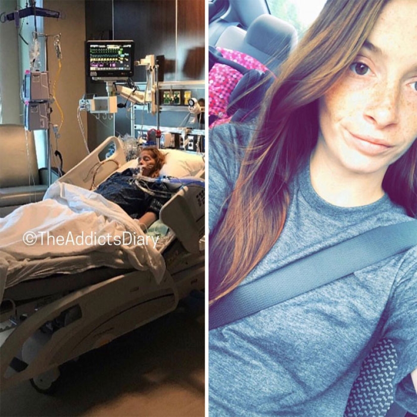 25 photos of people before and after overcoming addiction