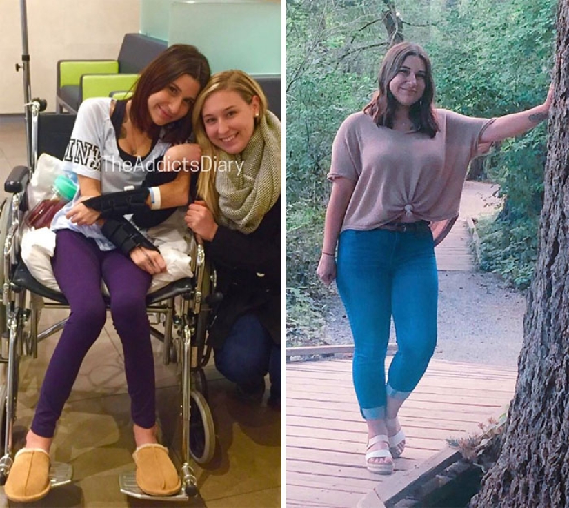 25 photos of people before and after overcoming addiction