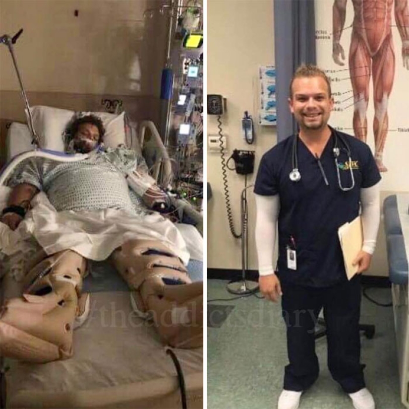 25 photos of people before and after overcoming addiction