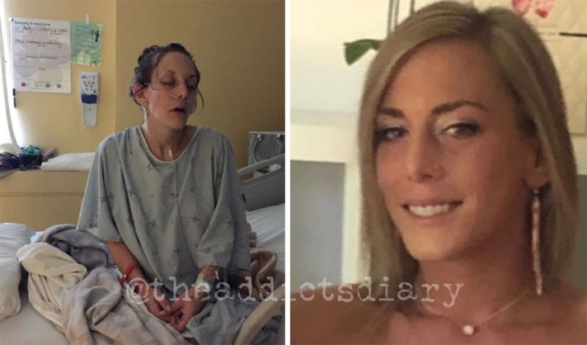 25 photos of people before and after overcoming addiction