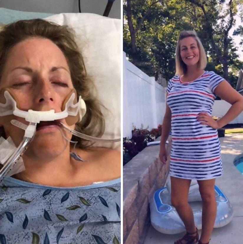 25 photos of people before and after overcoming addiction