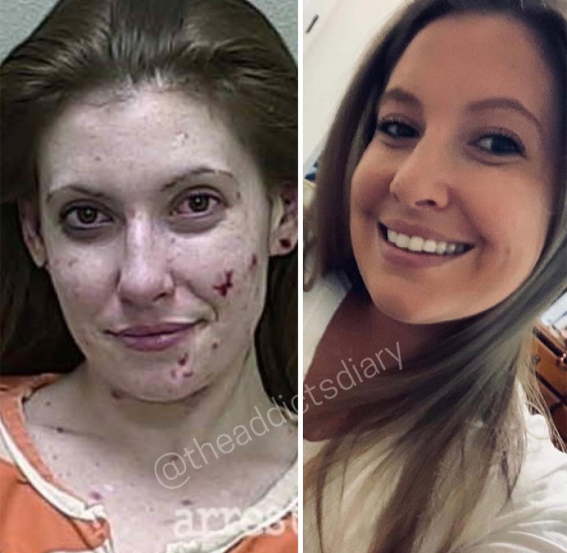 25 photos of people before and after overcoming addiction