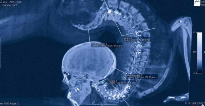 25 rare photos of Olympians showing what is happening behind the scenes of big sports