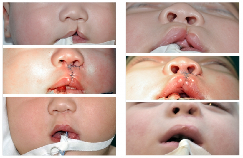 25 revelations of plastic surgeons who destroy stereotypes about their work