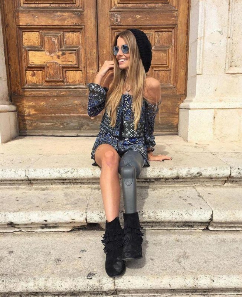 5 personas que han logrado el éxito a pesar de la discapacidad