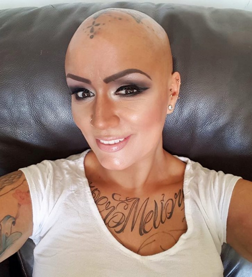 5 personas que han logrado el éxito a pesar de la discapacidad