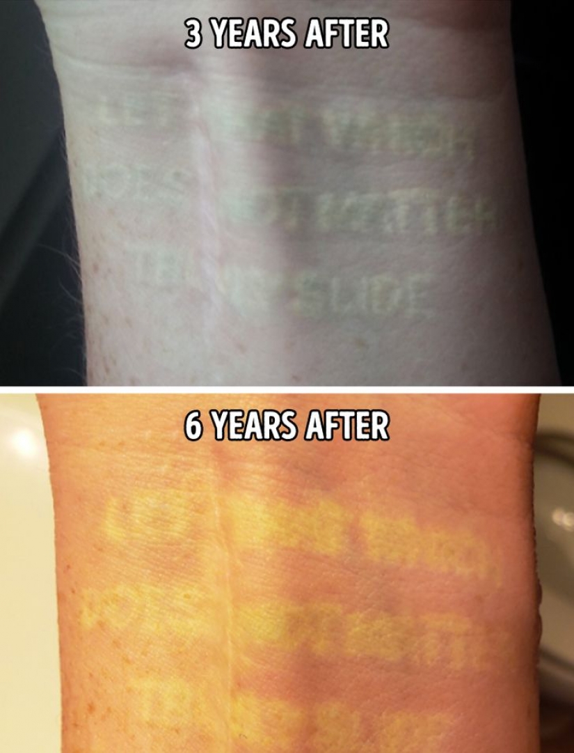 5 things to know before getting a white tattoo