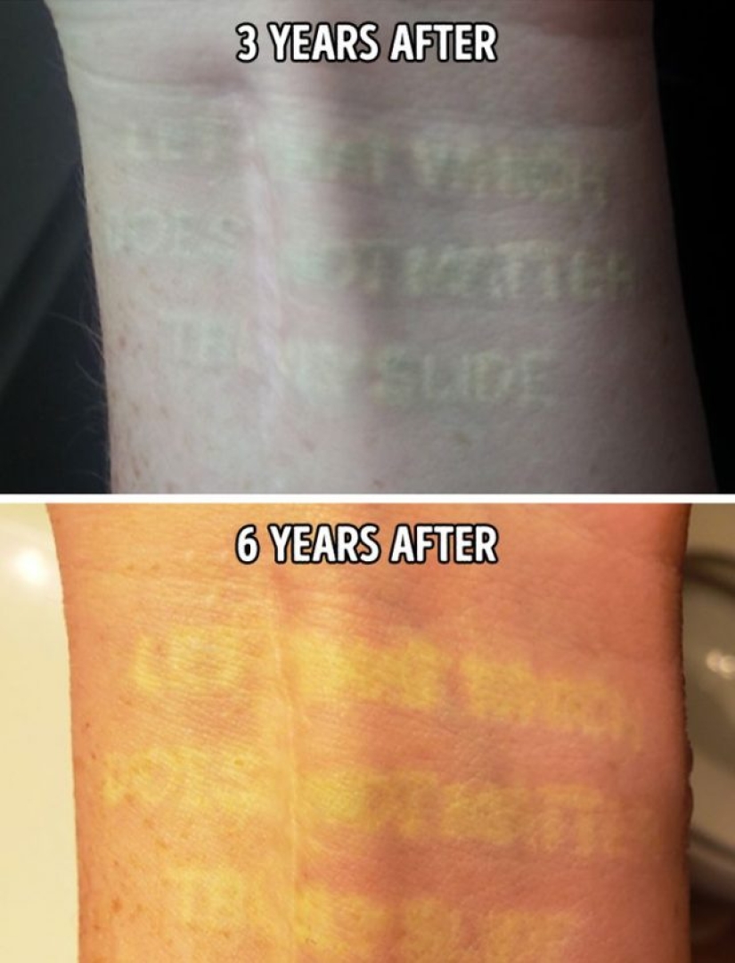 5 things you need to know before you get a white tattoo