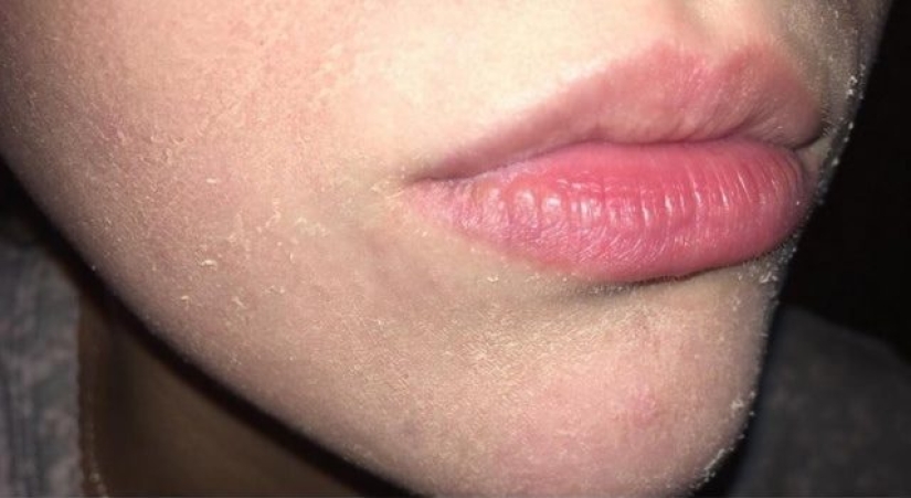 6 Signs Your Body Needs More Vitamin A 6 Signs Your Body Needs More Vitamin A