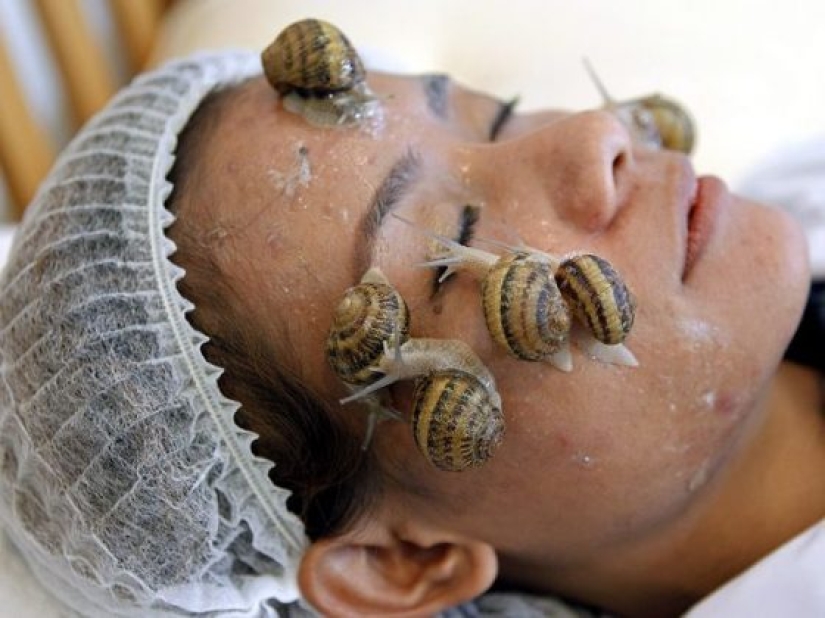 7 horribles procedimientos cosméticos populares en Hollywood 7 horribles procedimientos cosméticos populares en Hollywood