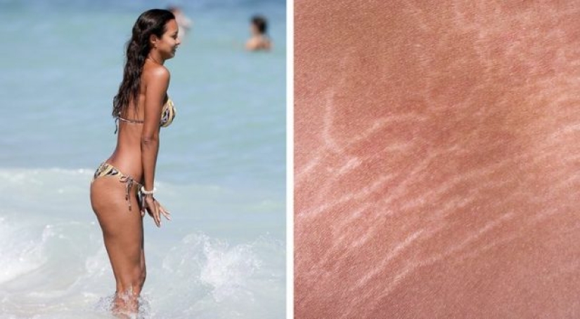 8 rasgos de la apariencia de una mujer que se consideran defectos irracionalmente