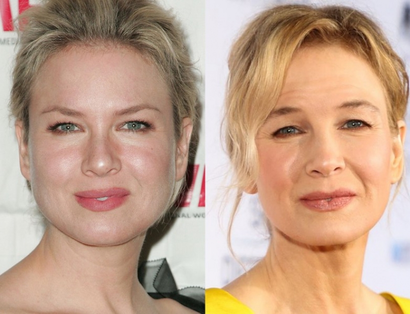 9 celebridades que la pérdida de peso ha hecho más viejo