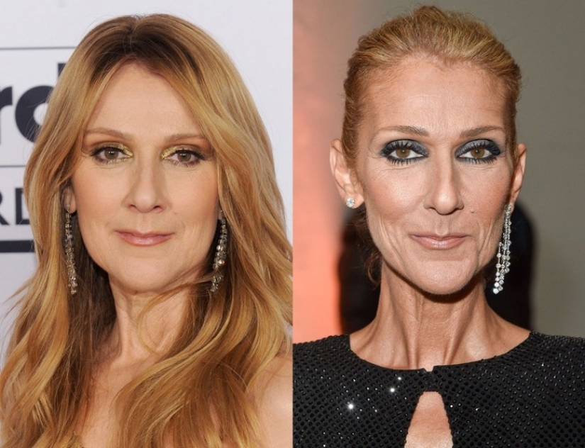 9 celebridades que la pérdida de peso ha hecho más viejo