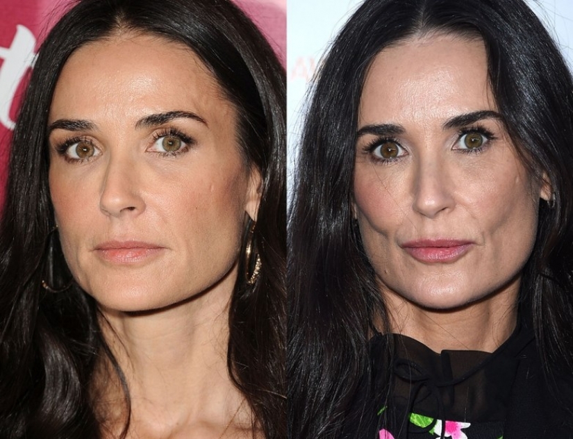 9 celebrities that weight loss has made older