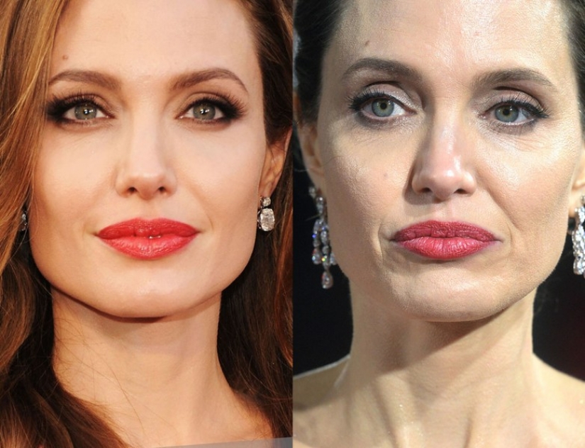 9 celebrities that weight loss has made older