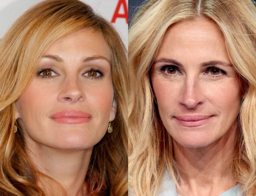 9 celebrities that weight loss has made older