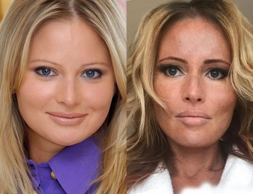 9 celebrities that weight loss has made older