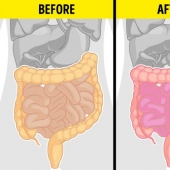 9 health conditions that mean it could be dangerous for you to eat tomatoes